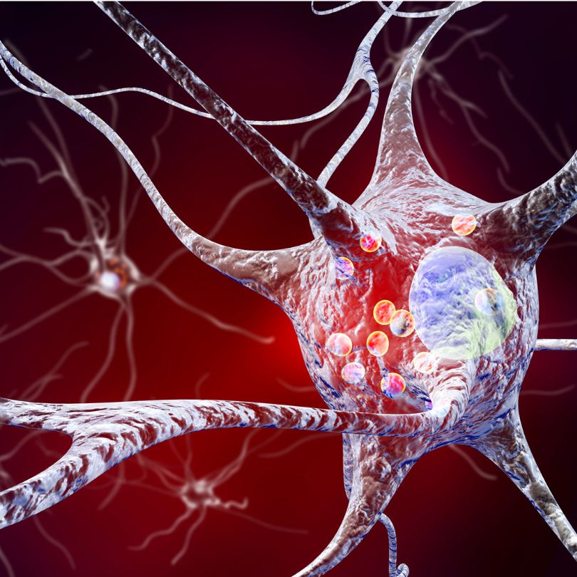 ¿Qué relación tiene el matcha con el Parkinson?